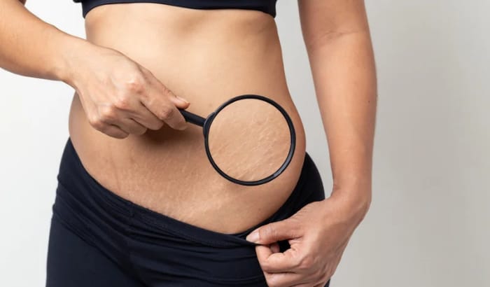 Person holding a magnifying glass to their stomach against a plain background