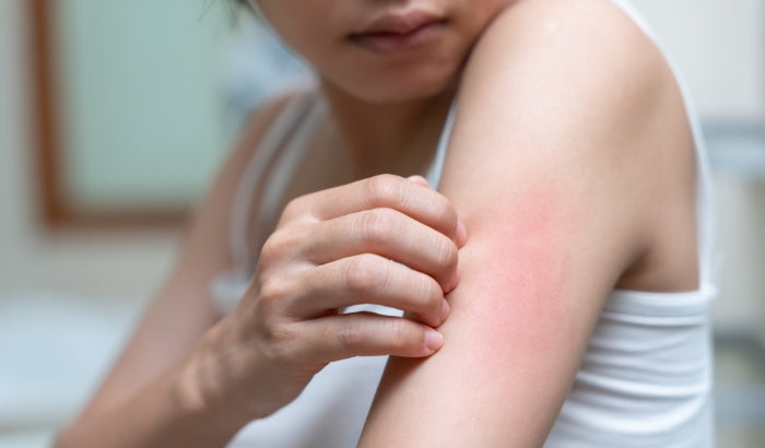 Person scratching an itchy arm with a blurred background