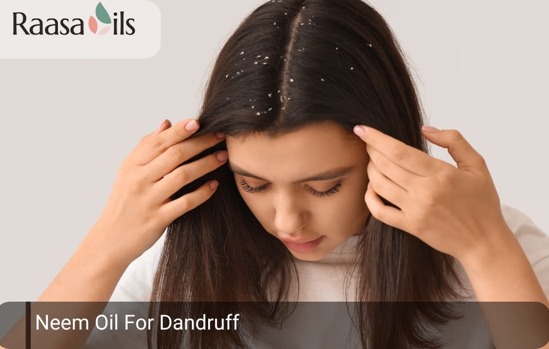 Neem Oil For Dandruff
