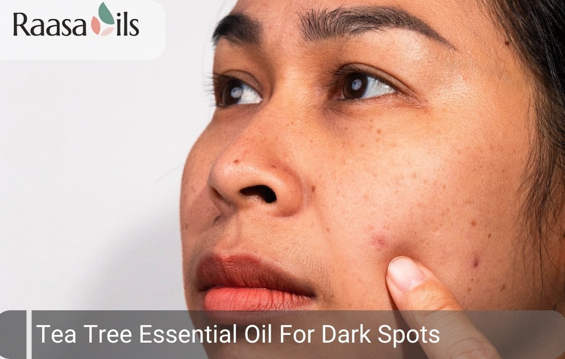 Tea Tree Essential Oil For Dark Spots