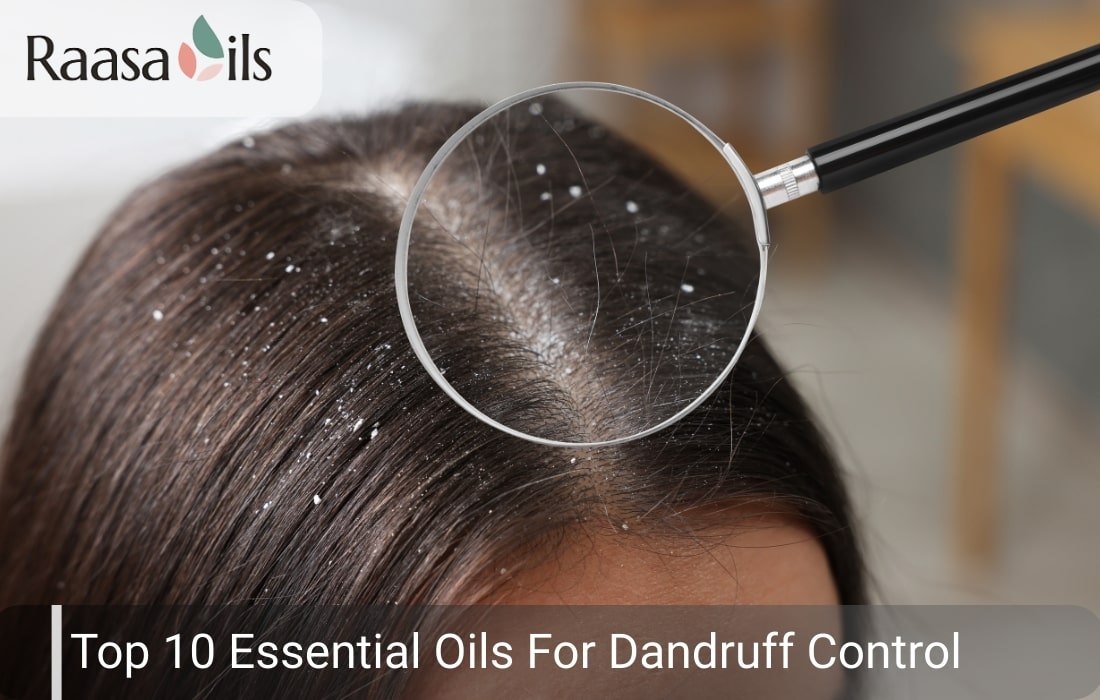 Best Essential Oils for Dandruff: Natural Care for Healthy, Clean Hair
