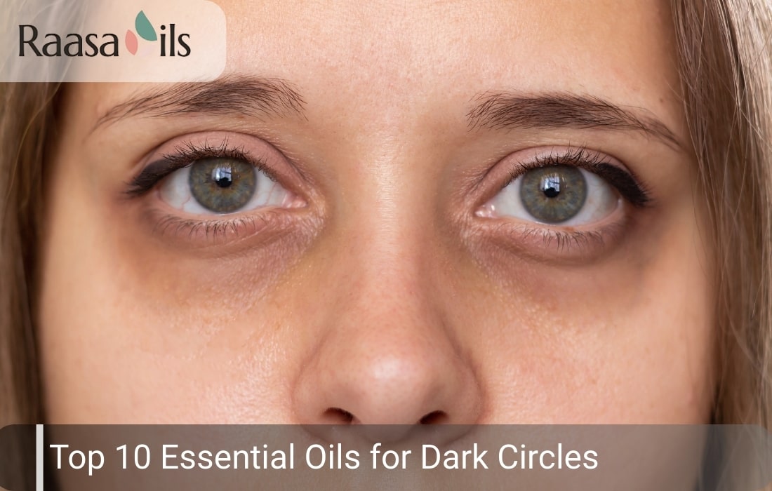 Top 10 Essential Oils For Dark Circles
