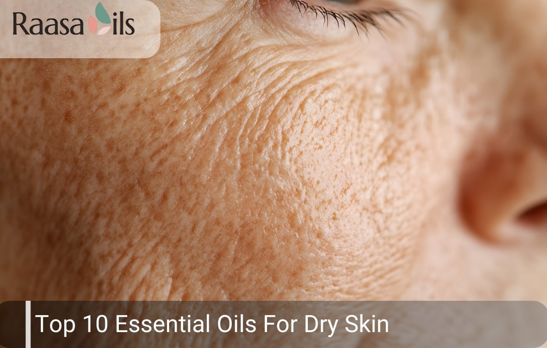 Top 10 Essential Oils For Dry Skin