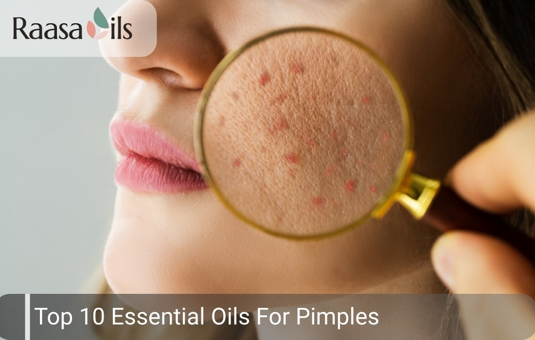 Top 10 Essential Oils for Pimples