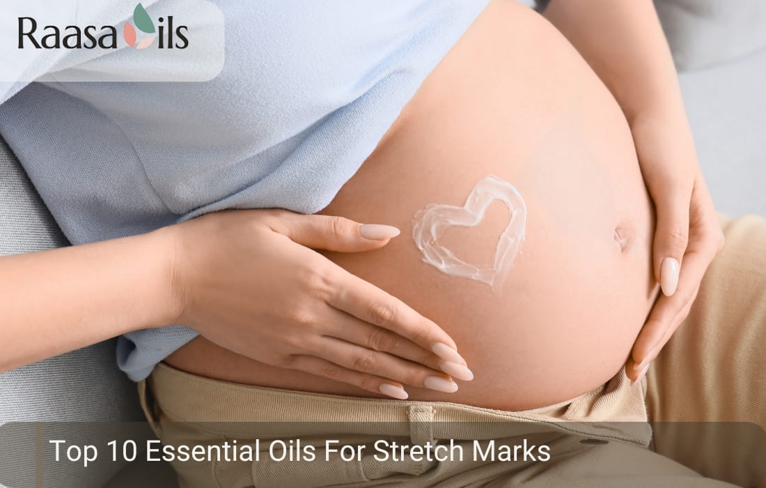 Top 10 Essential Oils for Stretch Marks