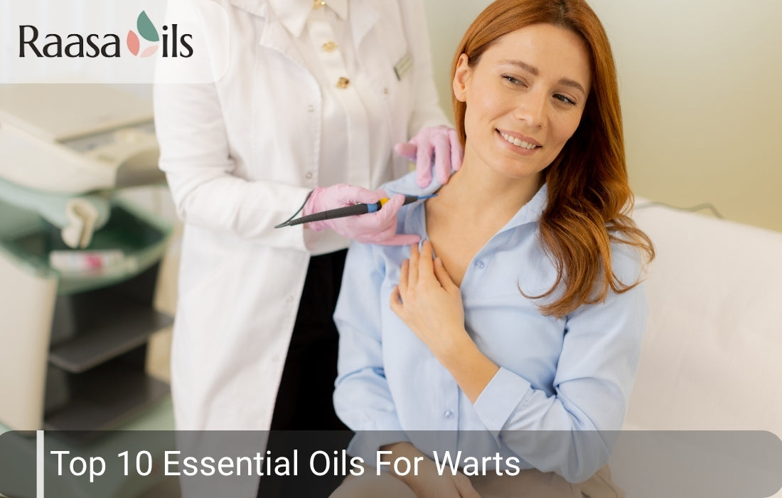 Top 10 Essential Oils For Warts