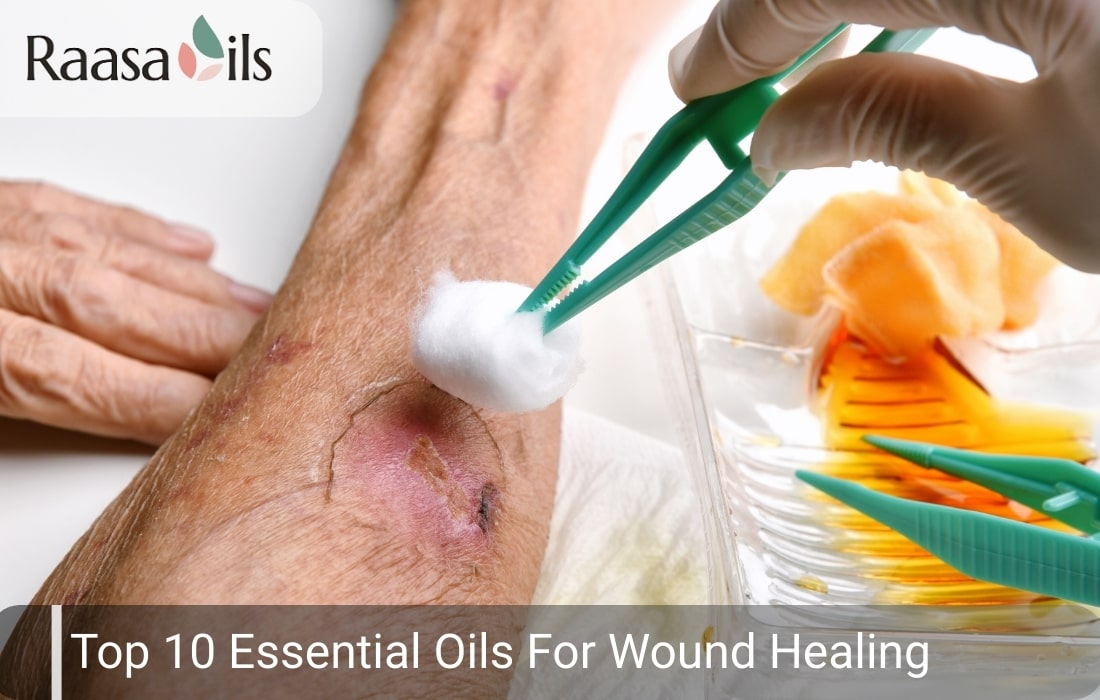Top 10 Essential Oils for Wound Healing