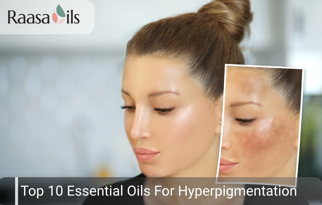 Top 10 Essential Oils for Hyperpigmentation